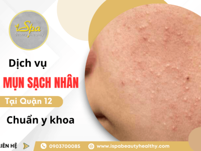 Dịch vụ nặn mụn sạch nhân Quận 12 uy tín, chuẩn y khoa tại Ispa Beauty & Healthy