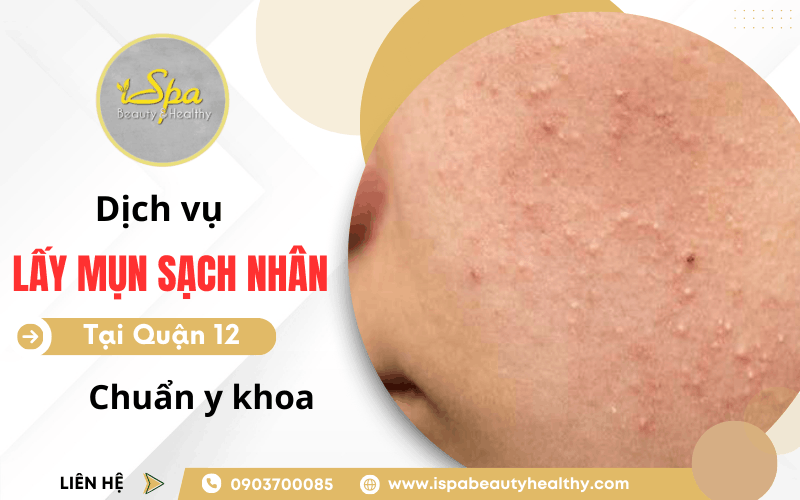 dịch vụ nặn mụn sạch nhân Quận 12